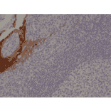 Immunohistochemistry - Anti-Cytokeratin 4 Antibody [RM355] (A121480) - Antibodies.com