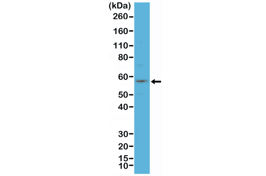 Western Blot - Anti-Cytokeratin 4 Antibody [RM355] (A121468) - Antibodies.com