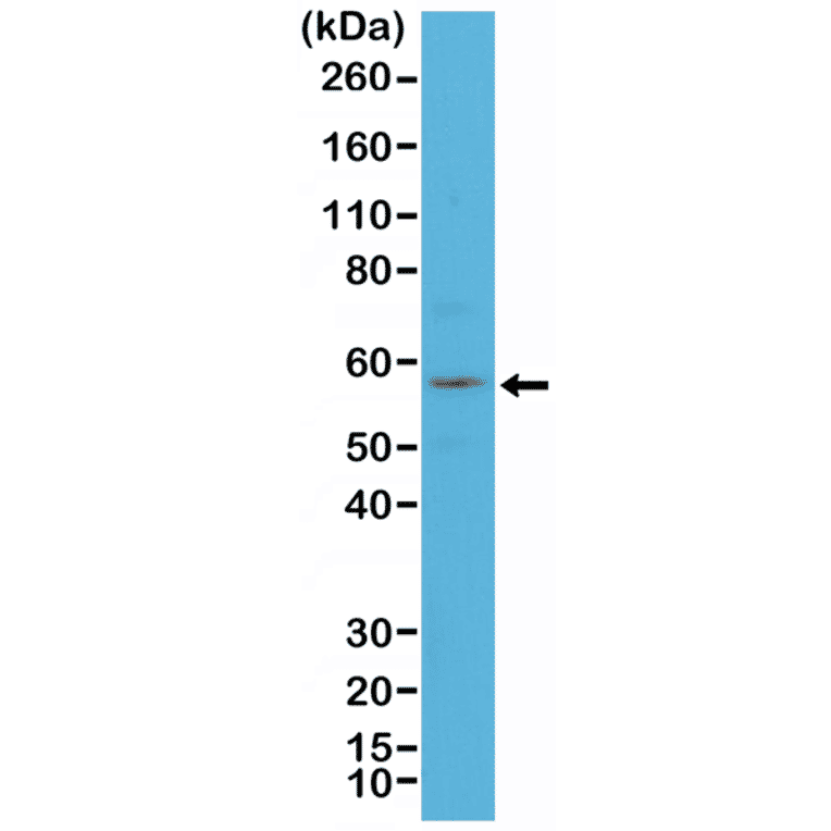 Western Blot - Anti-Cytokeratin 4 Antibody [RM355] (A121468) - Antibodies.com