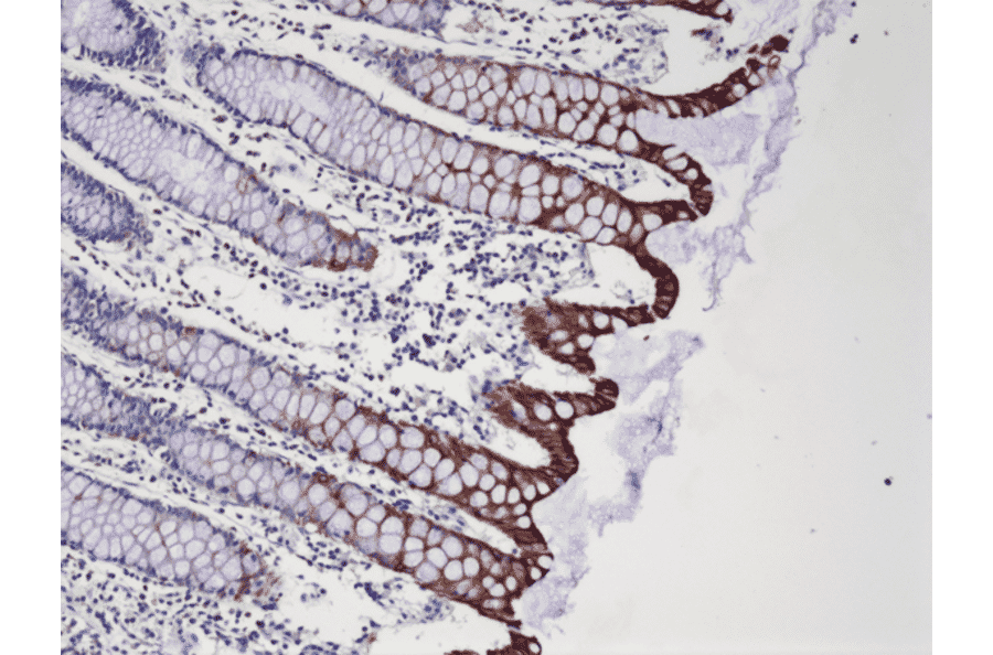 Immunohistochemistry - Anti-Cytokeratin 20 Antibody [RM283] (A121473) - Antibodies.com