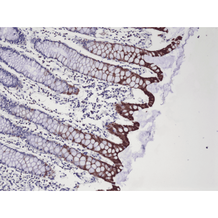 Immunohistochemistry - Anti-Cytokeratin 20 Antibody [RM283] (A121473) - Antibodies.com