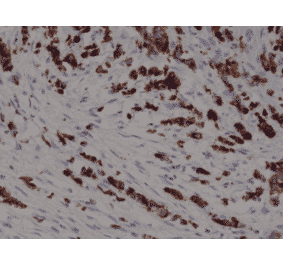Immunohistochemistry - Anti-Cytokeratin 19 Antibody [RM364] (A121405) - Antibodies.com