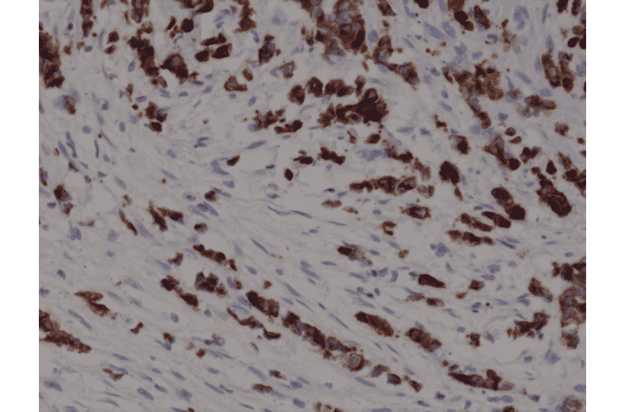 Immunohistochemistry - Anti-Cytokeratin 19 Antibody [RM364] (A121405) - Antibodies.com