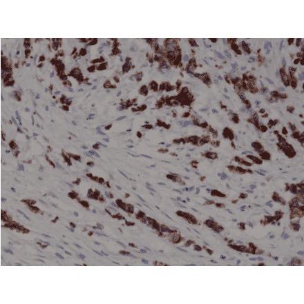 Immunohistochemistry - Anti-Cytokeratin 19 Antibody [RM364] (A121405) - Antibodies.com