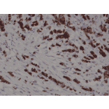 Immunohistochemistry - Anti-Cytokeratin 19 Antibody [RM364] (A121405) - Antibodies.com