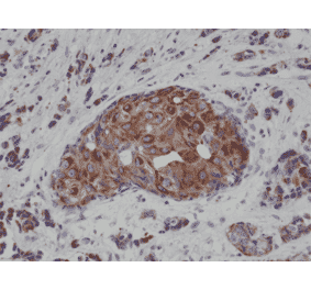 Immunohistochemistry - Anti-Cytokeratin 18 Antibody [RM279] (A121295) - Antibodies.com