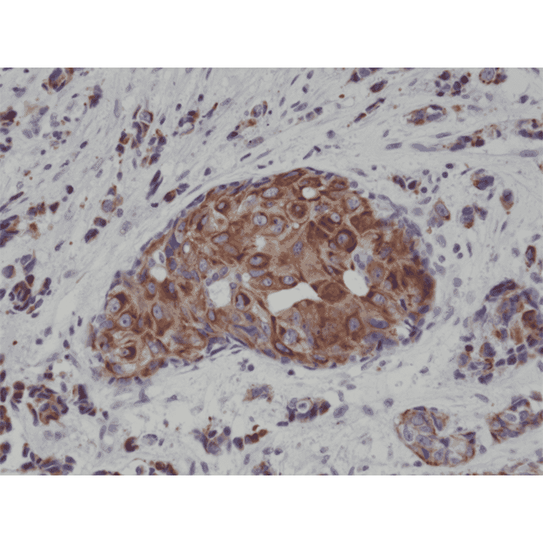Immunohistochemistry - Anti-Cytokeratin 18 Antibody [RM279] (A121295) - Antibodies.com