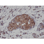 Immunohistochemistry - Anti-Cytokeratin 18 Antibody [RM279] (A121295) - Antibodies.com