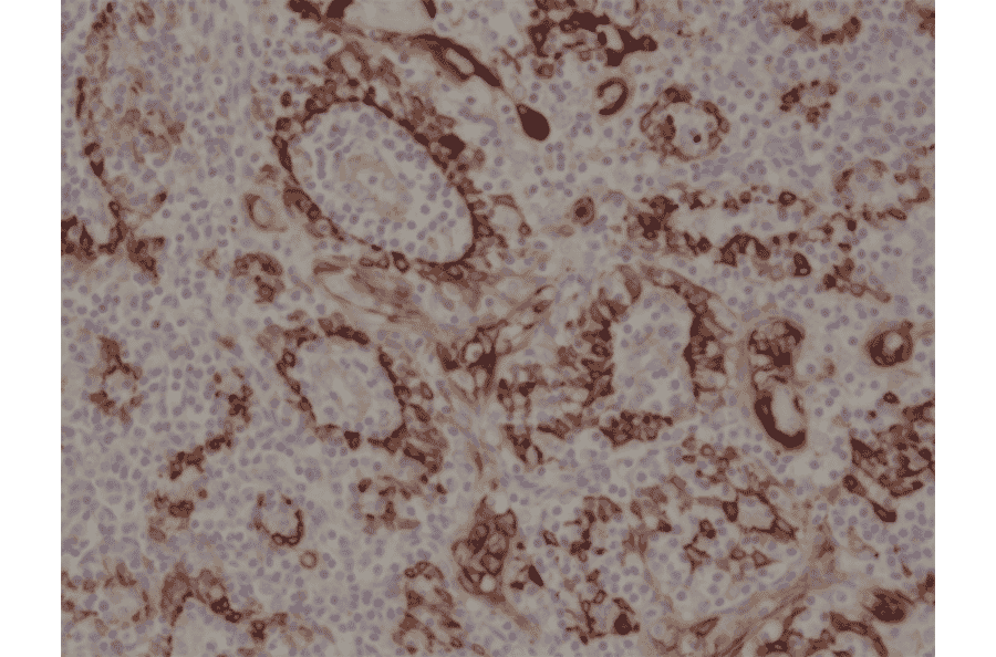 Immunohistochemistry - Anti-Cytokeratin 17 Antibody [RM351] (A121377) - Antibodies.com