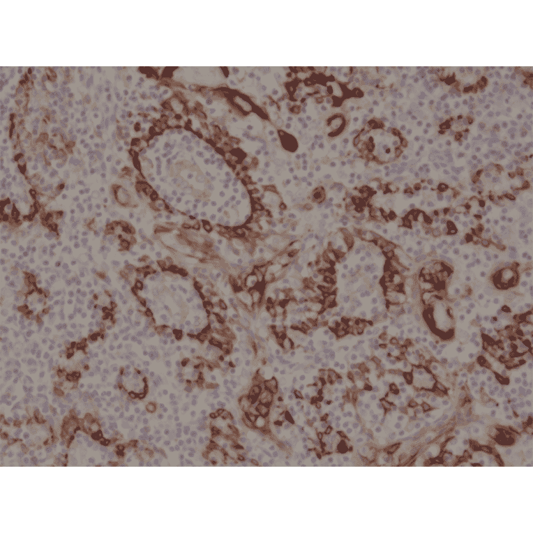 Immunohistochemistry - Anti-Cytokeratin 17 Antibody [RM351] (A121377) - Antibodies.com