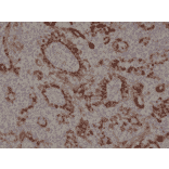 Immunohistochemistry - Anti-Cytokeratin 17 Antibody [RM351] (A121377) - Antibodies.com