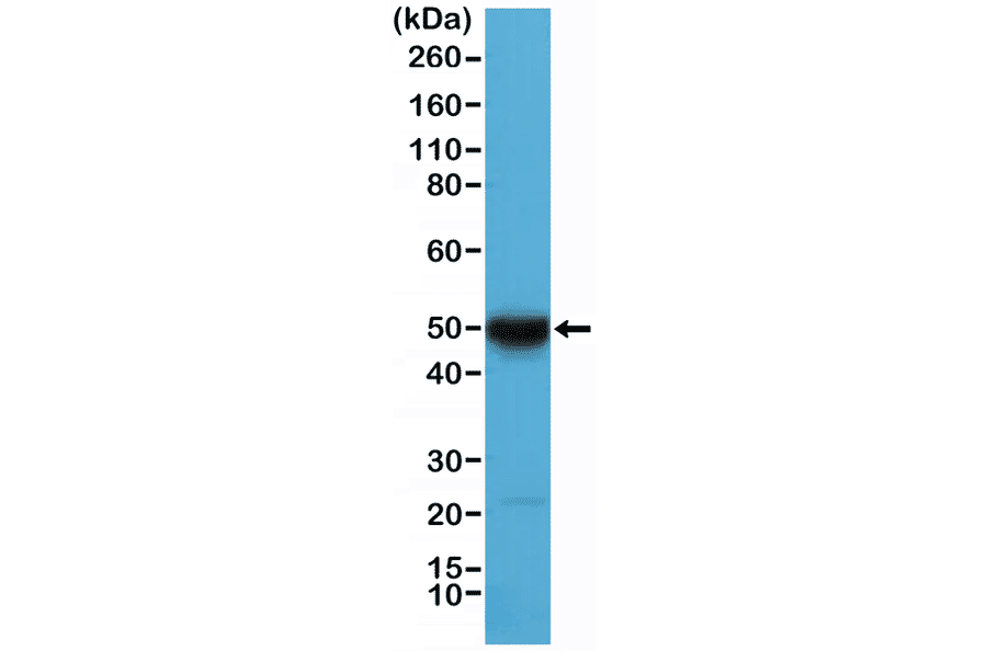 Western Blot - Anti-Cytokeratin 17 Antibody [RM351] (A121472) - Antibodies.com