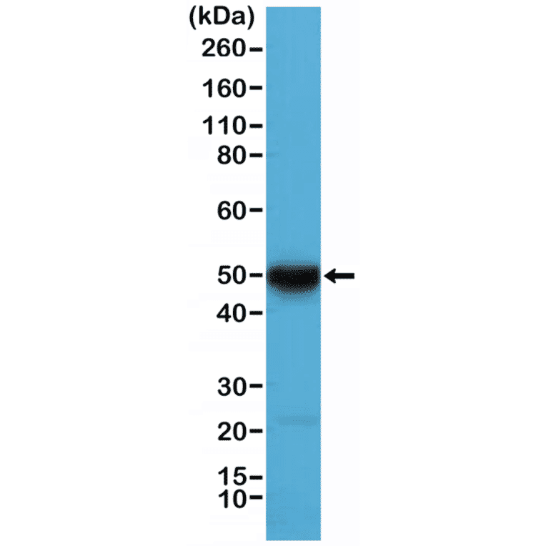 Western Blot - Anti-Cytokeratin 17 Antibody [RM351] (A121472) - Antibodies.com