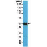 Western Blot - Anti-Cytokeratin 17 Antibody [RM351] (A121472) - Antibodies.com