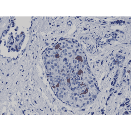 Immunohistochemistry - Anti-Cyclin B1 Antibody [RM281] (A121449) - Antibodies.com