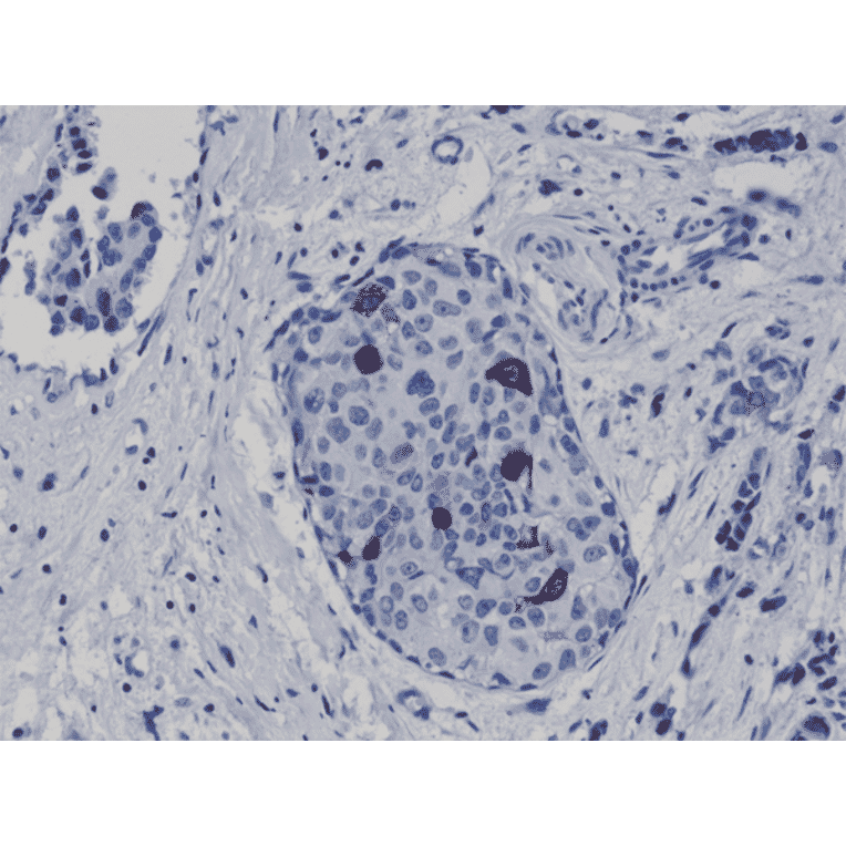 Immunohistochemistry - Anti-Cyclin B1 Antibody [RM281] (A121449) - Antibodies.com