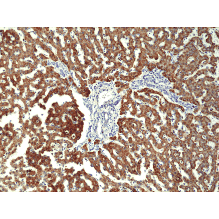 Immunohistochemistry - Anti-CPS1 Antibody [RM395] (A121424) - Antibodies.com