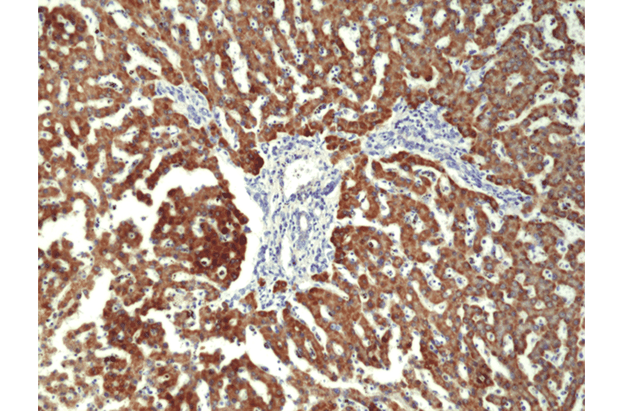 Immunohistochemistry - Anti-CPS1 Antibody [RM395] (A121474) - Antibodies.com