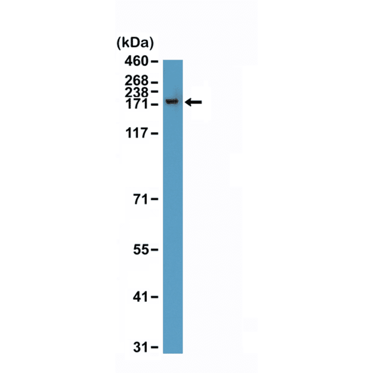 Western Blot - Anti-CPS1 Antibody [RM395] (A121474) - Antibodies.com