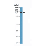 Western Blot - Anti-CPS1 Antibody [RM395] (A121474) - Antibodies.com