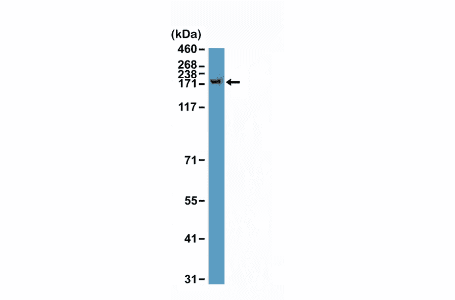 Western Blot - Anti-CPS1 Antibody [RM395] (A121474) - Antibodies.com