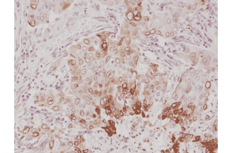 Immunohistochemistry - Anti-COX2 Antibody [RM348] (A121456) - Antibodies.com