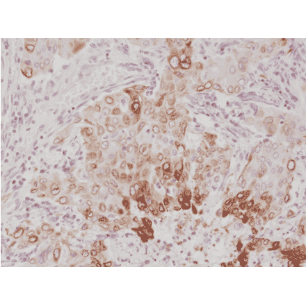 Immunohistochemistry - Anti-COX2 Antibody [RM348] (A121456) - Antibodies.com