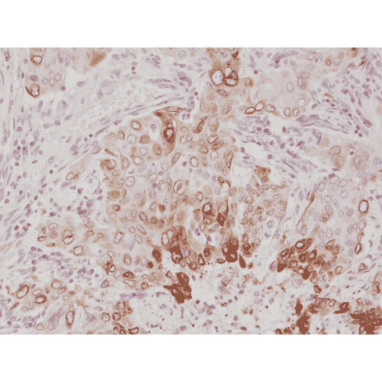 Immunohistochemistry - Anti-COX2 Antibody [RM348] (A121456) - Antibodies.com