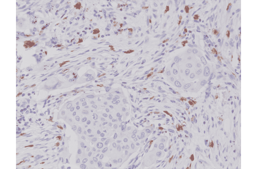Immunohistochemistry - Anti-c-Kit Antibody [RM359] (A121380) - Antibodies.com