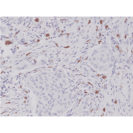 Immunohistochemistry - Anti-c-Kit Antibody [RM359] (A121380) - Antibodies.com