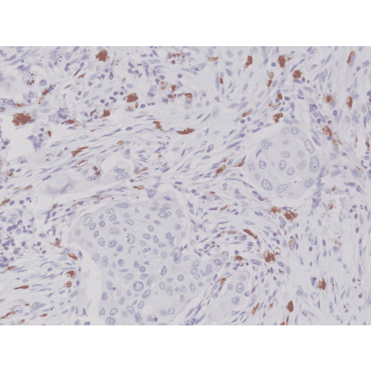 Immunohistochemistry - Anti-c-Kit Antibody [RM359] (A121380) - Antibodies.com