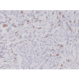 Immunohistochemistry - Anti-c-Kit Antibody [RM359] (A121380) - Antibodies.com