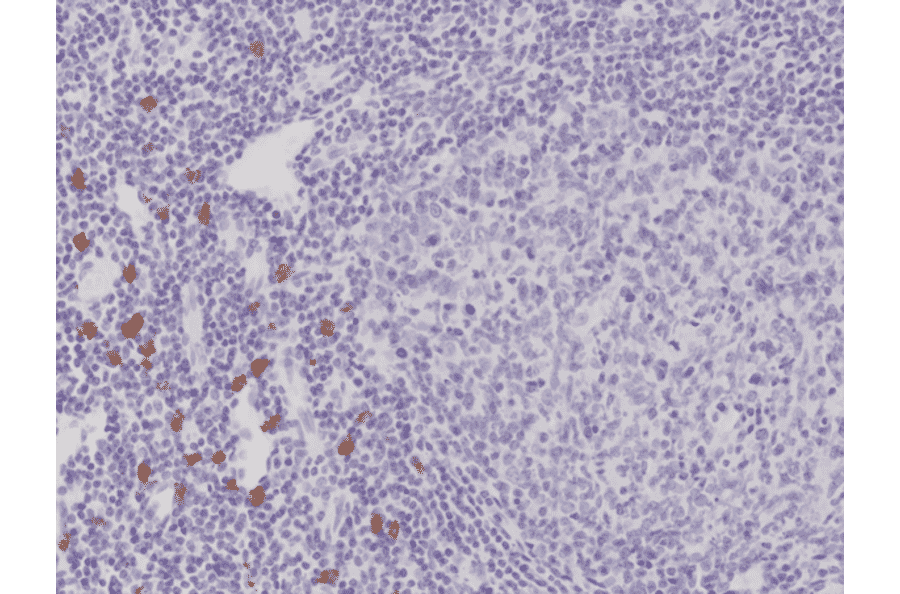 IHC of FFPE human tonsil stained with recombinant mouse anti-c-Kit [RM359] (A121476).