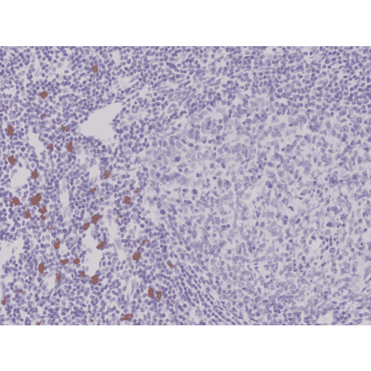 Immunohistochemistry - Anti-c-Kit Antibody [RM359] (A121476) - Antibodies.com
