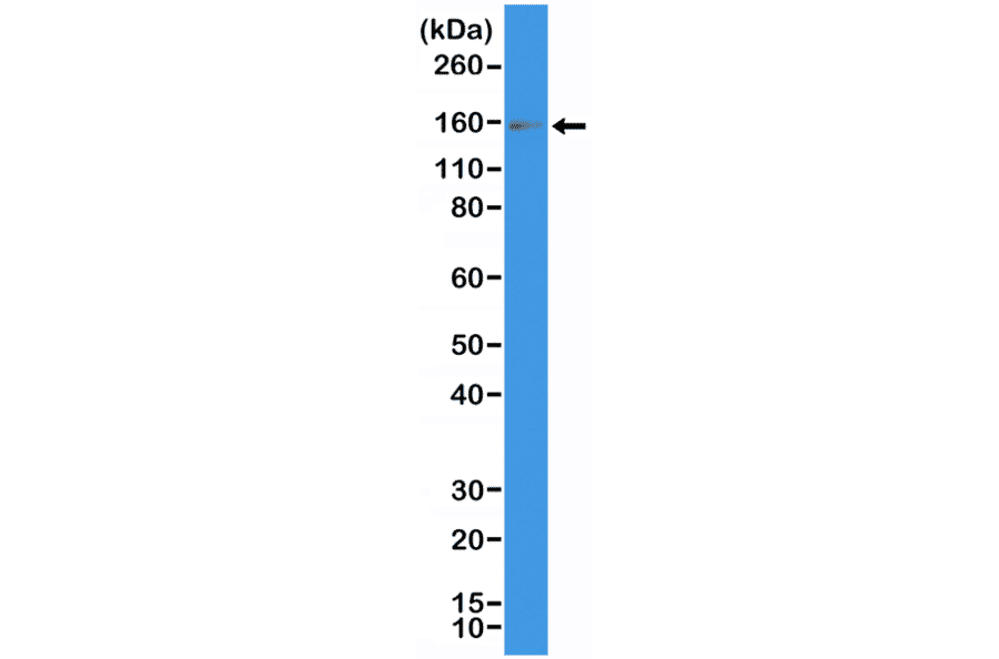 Western Blot - Anti-c-Kit Antibody [RM359] (A121476) - Antibodies.com