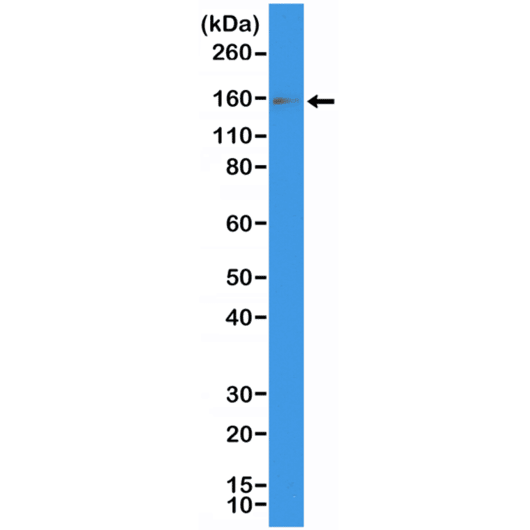 Western Blot - Anti-c-Kit Antibody [RM359] (A121476) - Antibodies.com