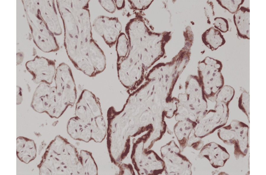 Immunohistochemistry - Anti-hCG Antibody [RM330] (A121389) - Antibodies.com