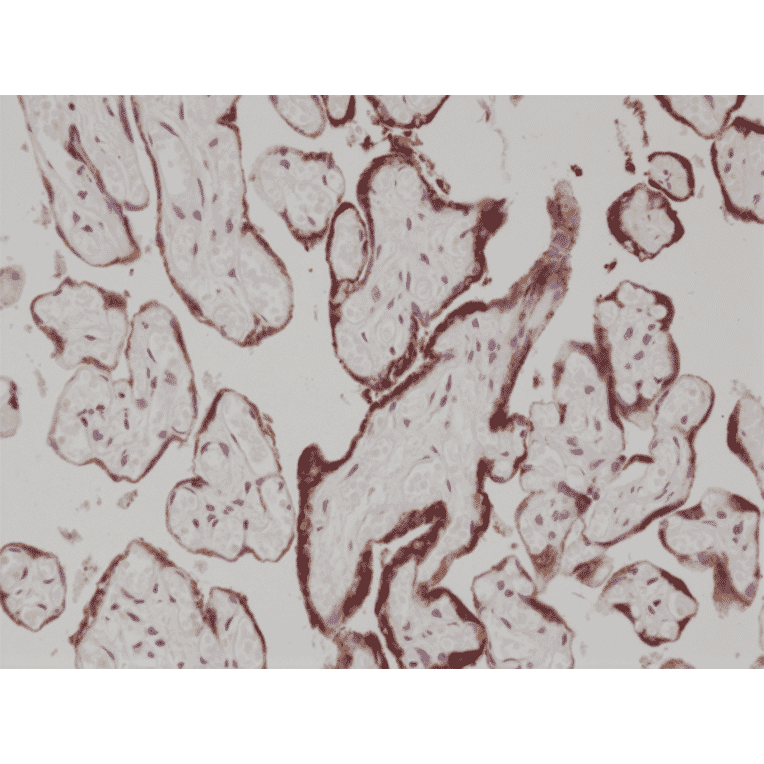 Immunohistochemistry - Anti-hCG Antibody [RM330] (A121389) - Antibodies.com