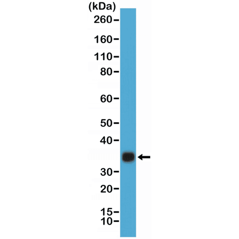 Western Blot - Anti-hCG Antibody [RM330] (A121477) - Antibodies.com