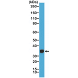 Western Blot - Anti-hCG Antibody [RM330] (A121477) - Antibodies.com