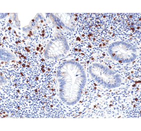 Immunohistochemistry - Anti-CD8a Antibody [RM397] (A121496) - Antibodies.com