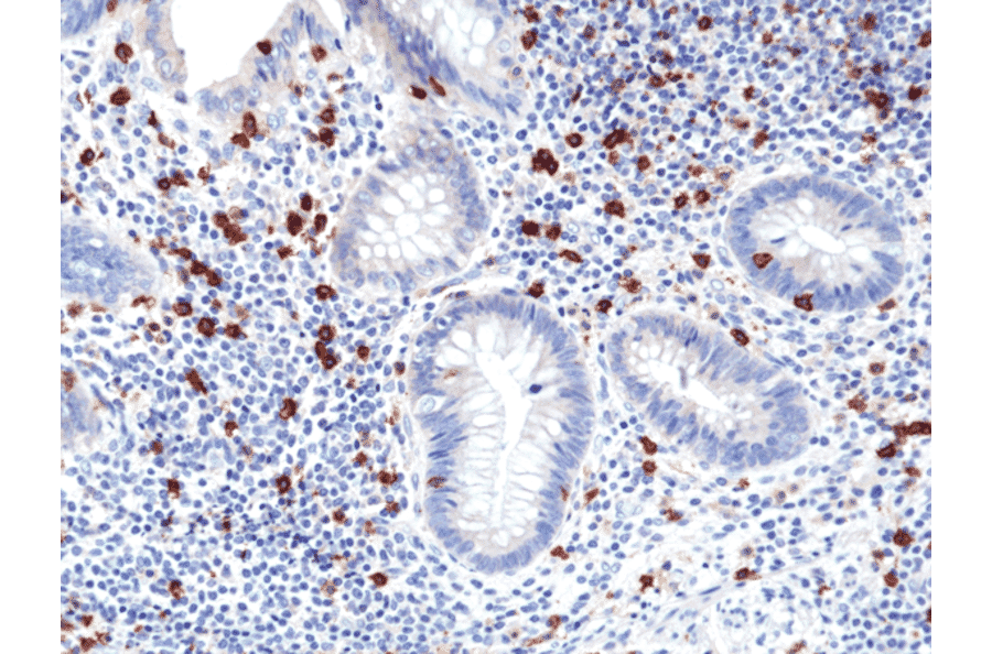 Immunohistochemistry - Anti-CD8a Antibody [RM397] (A121496) - Antibodies.com
