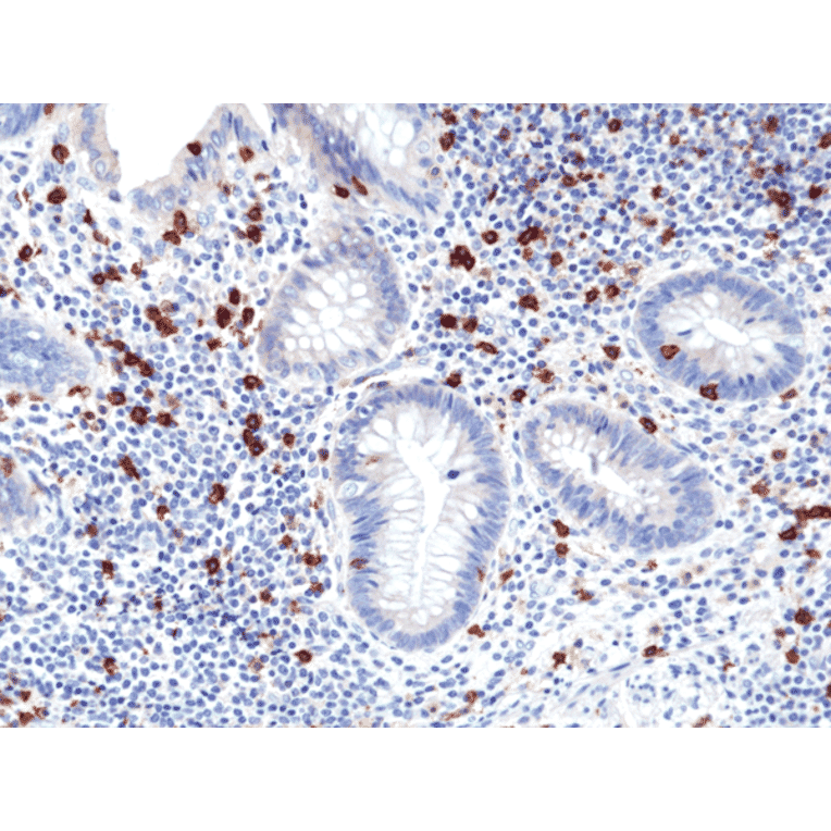 Immunohistochemistry - Anti-CD8a Antibody [RM397] (A121496) - Antibodies.com