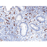 Immunohistochemistry - Anti-CD8a Antibody [RM397] (A121496) - Antibodies.com