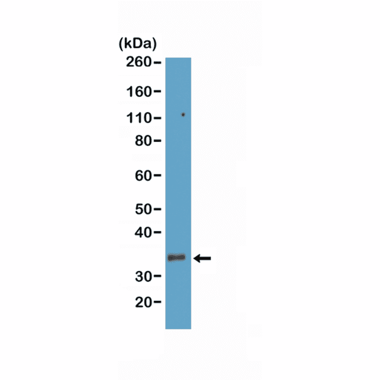 Western Blot - Anti-CD8a Antibody [RM397] (A121478) - Antibodies.com