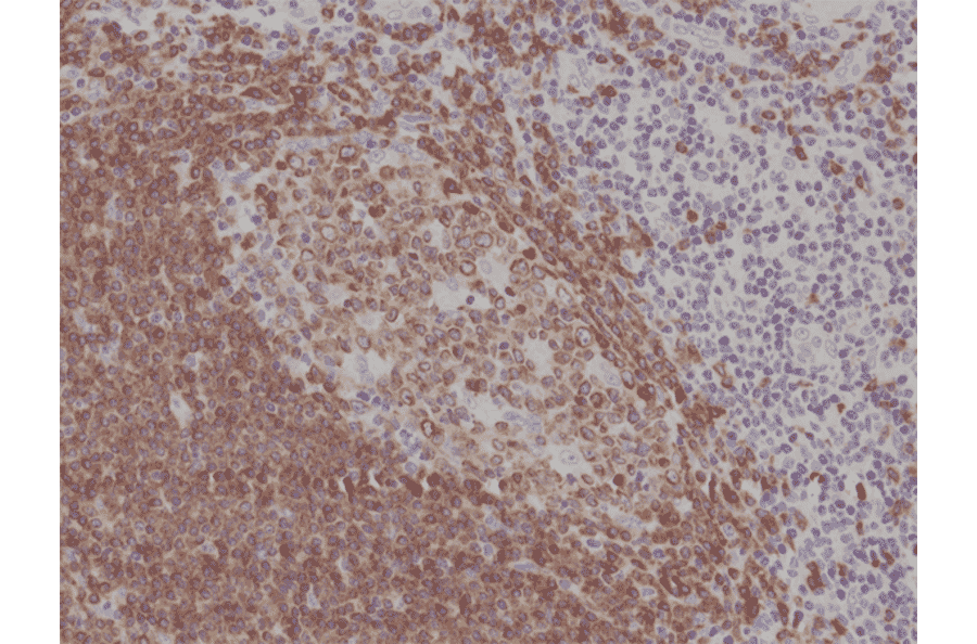 Immunohistochemistry - Anti-CD79a Antibody [RM297] (A121301) - Antibodies.com