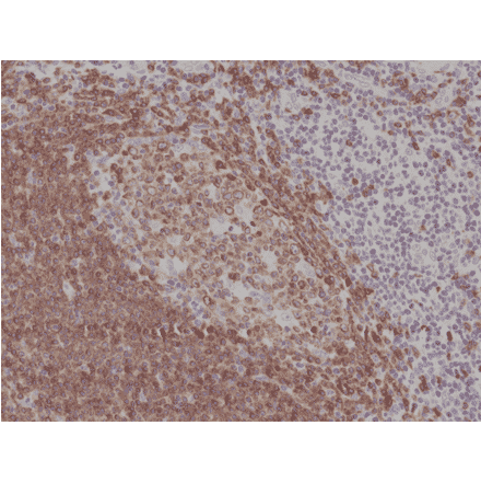 Immunohistochemistry - Anti-CD79a Antibody [RM297] (A121301) - Antibodies.com