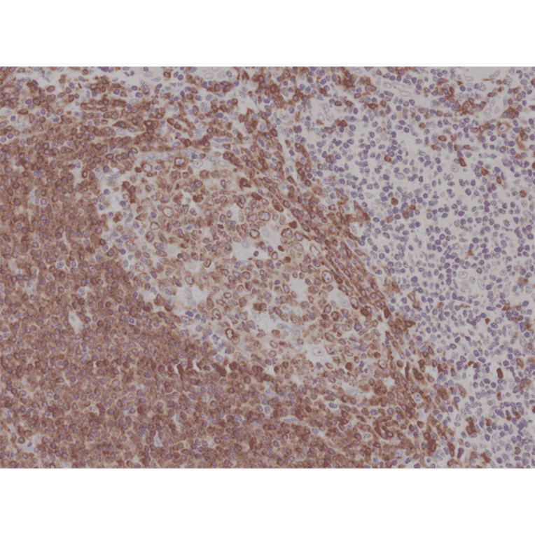 Immunohistochemistry - Anti-CD79a Antibody [RM297] (A121301) - Antibodies.com