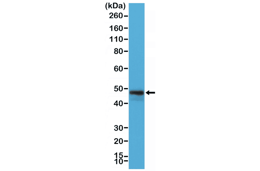 Western Blot - Anti-CD79a Antibody [RM297] (A121479) - Antibodies.com