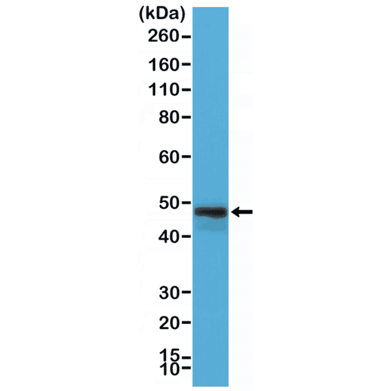 Western Blot - Anti-CD79a Antibody [RM297] (A121479) - Antibodies.com